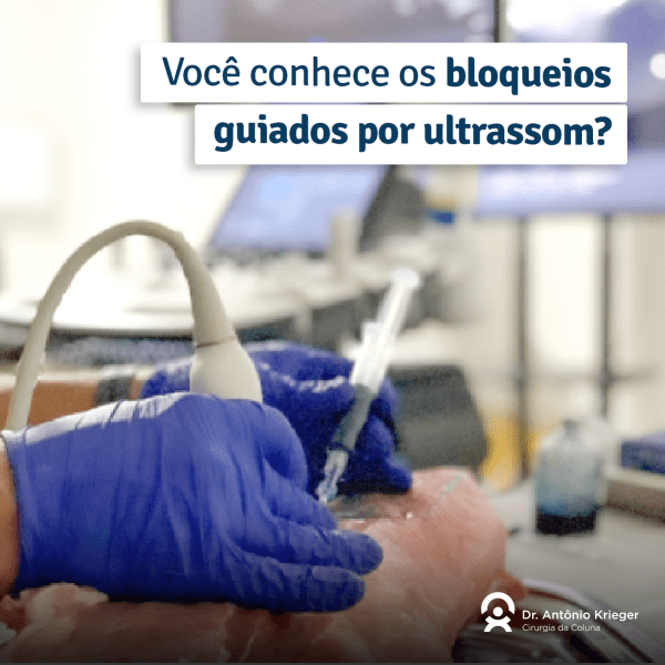 Voc Conhece Os Bloqueios Guiados Por Ultrassom Dr Ant Nio Krieger