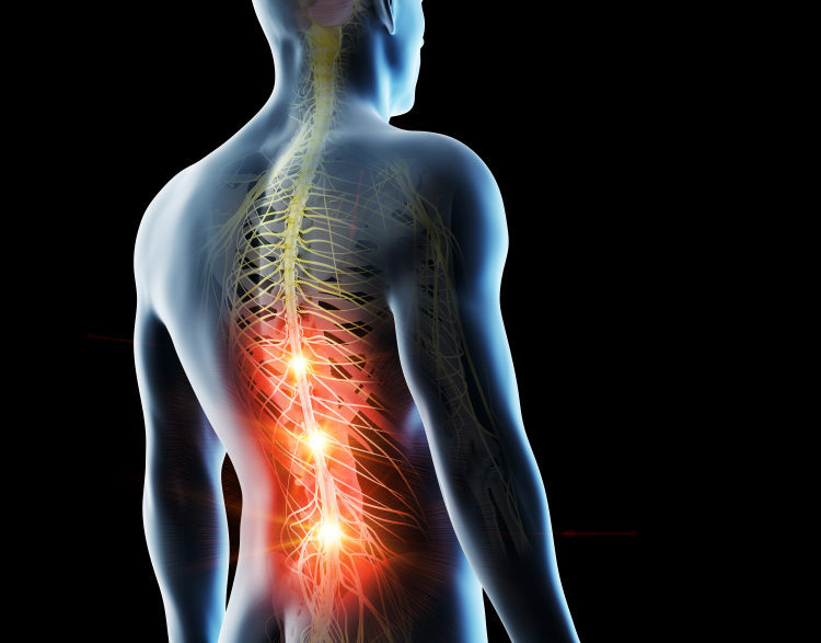 Doenças na coluna irradiam dores por todo o corpo