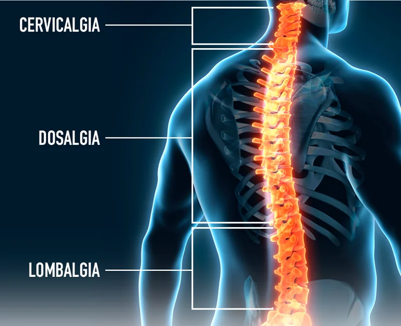 Diferença entre cervicalgia, dorsalgia e lombalgia