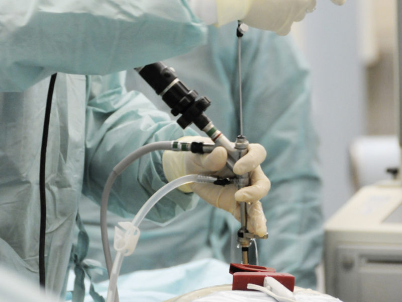Atletas submetidos a endoscopia para hérnia de disco retornam ao esporte em até oito semanas, diz estudo