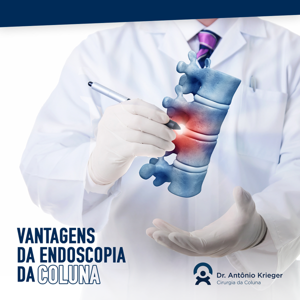 Vantagens da endoscopia da coluna